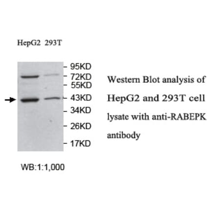 RABEPK Antibody from Signalway Antibody (39757) - Antibodies.com