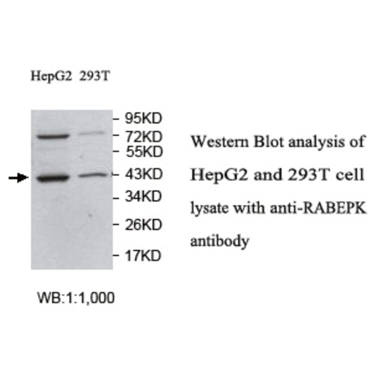 RABEPK Antibody from Signalway Antibody (39757) - Antibodies.com