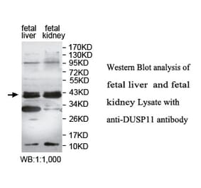 DUSP11 Antibody from Signalway Antibody (39758) - Antibodies.com