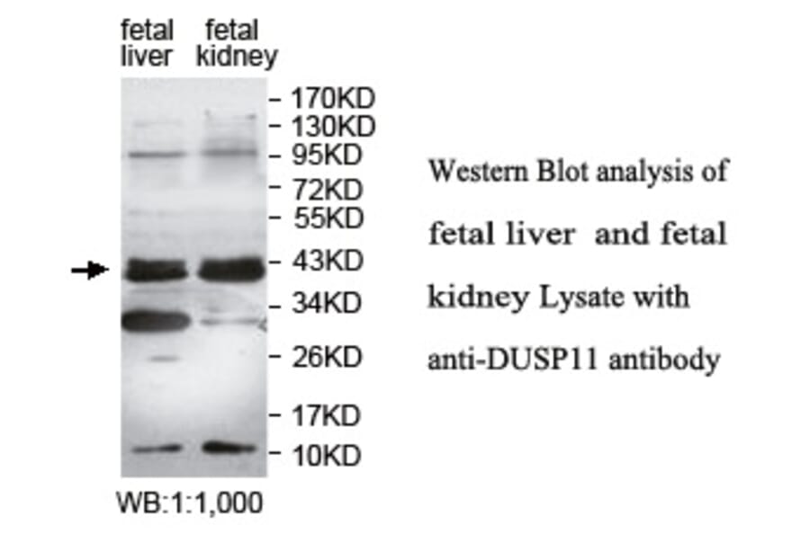 DUSP11 Antibody from Signalway Antibody (39758) - Antibodies.com