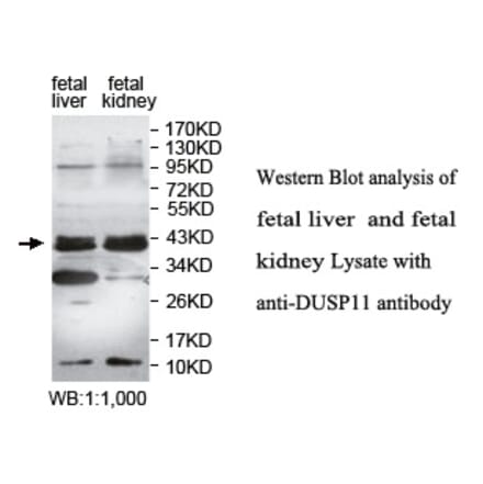 DUSP11 Antibody from Signalway Antibody (39758) - Antibodies.com