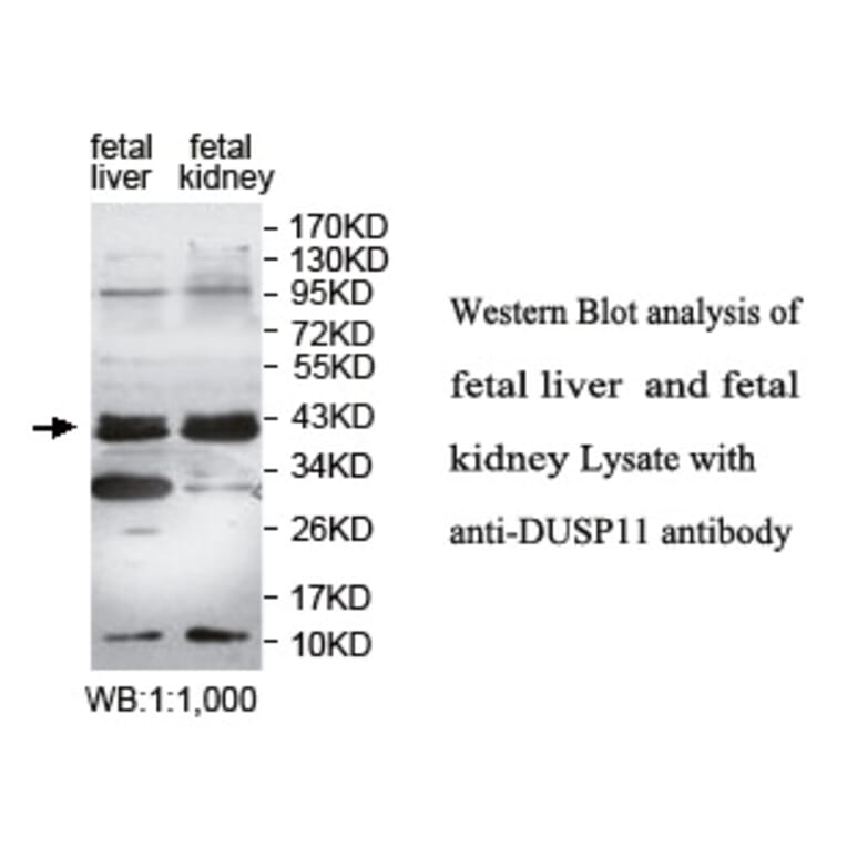 DUSP11 Antibody from Signalway Antibody (39758) - Antibodies.com