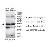 DUSP11 Antibody from Signalway Antibody (39758) - Antibodies.com