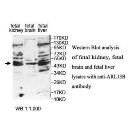 ARL13B Antibody from Signalway Antibody (39934) - Antibodies.com