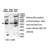 ARL13B Antibody from Signalway Antibody (39934) - Antibodies.com