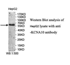 KCNA10 Antibody from Signalway Antibody (39958) - Antibodies.com