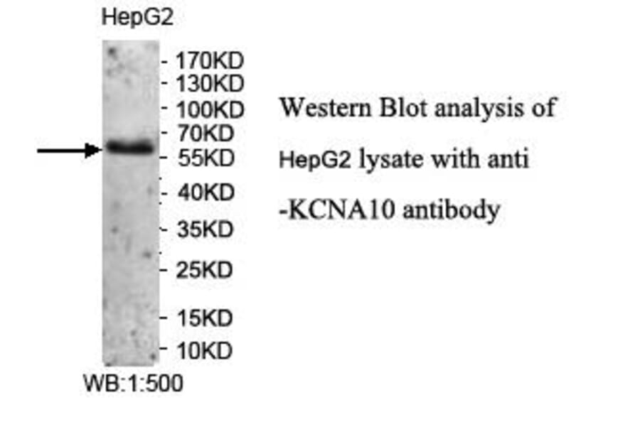 KCNA10 Antibody from Signalway Antibody (39958) - Antibodies.com