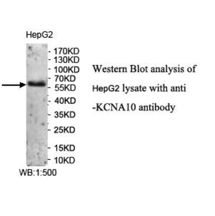 KCNA10 Antibody from Signalway Antibody (39958) - Antibodies.com