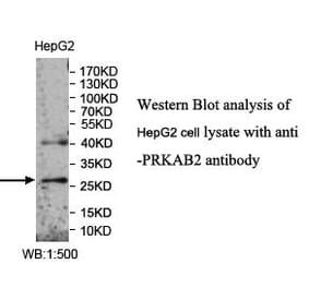 PRKAB2 Antibody from Signalway Antibody (39989) - Antibodies.com