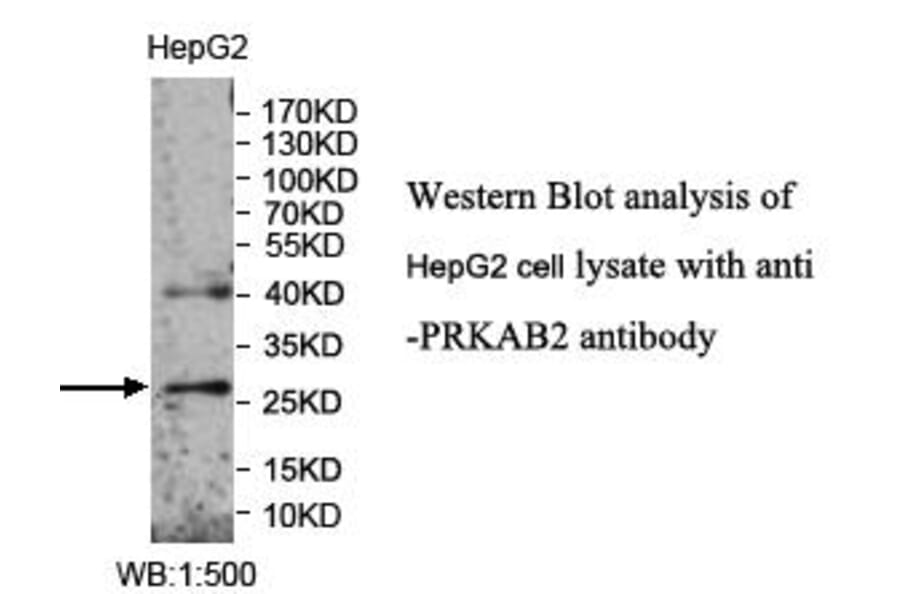 PRKAB2 Antibody from Signalway Antibody (39989) - Antibodies.com