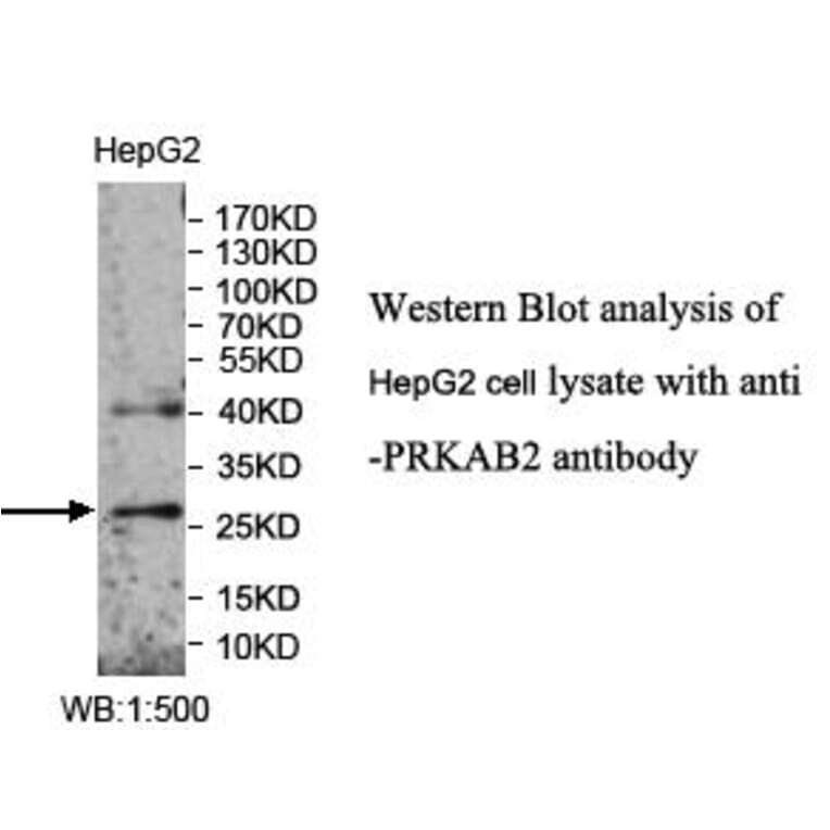 PRKAB2 Antibody from Signalway Antibody (39989) - Antibodies.com