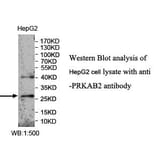 PRKAB2 Antibody from Signalway Antibody (39989) - Antibodies.com