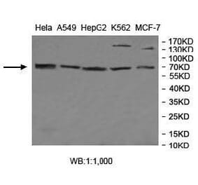 MGAT4A Antibody from Signalway Antibody (40012) - Antibodies.com