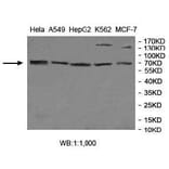 MGAT4A Antibody from Signalway Antibody (40012) - Antibodies.com