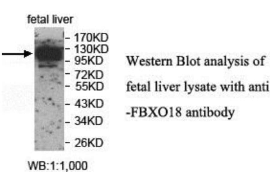 FBXO18 Antibody from Signalway Antibody (40045) - Antibodies.com