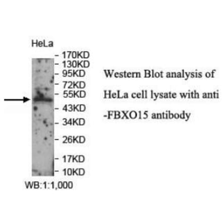 FBXO15 Antibody from Signalway Antibody (40046) - Antibodies.com