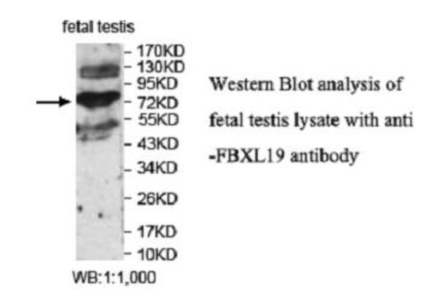 FBXL19 Antibody from Signalway Antibody (40047) - Antibodies.com