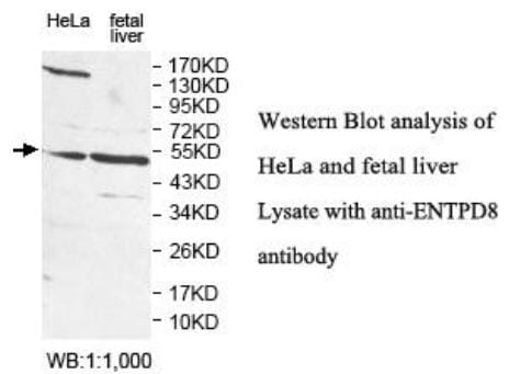 Anti-ENTPD8 Antibody