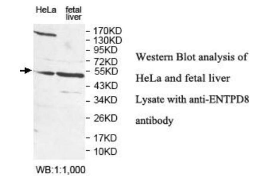 ENTPD8 Antibody from Signalway Antibody (40051) - Antibodies.com