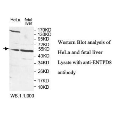 ENTPD8 Antibody from Signalway Antibody (40051) - Antibodies.com