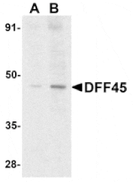 Western blot - DFF45 Antibody from Signalway Antibody (24024) - Antibodies.com