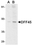 Western blot - DFF45 Antibody from Signalway Antibody (24024) - Antibodies.com