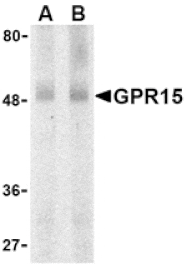 Western blot - GPR15 Antibody from Signalway Antibody (24059) - Antibodies.com