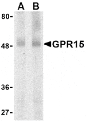 Western blot - GPR15 Antibody from Signalway Antibody (24059) - Antibodies.com