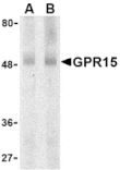 Western blot - GPR15 Antibody from Signalway Antibody (24059) - Antibodies.com