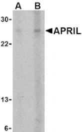 Western blot - APRIL Antibody from Signalway Antibody (24089) - Antibodies.com