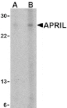 Western blot - APRIL Antibody from Signalway Antibody (24089) - Antibodies.com