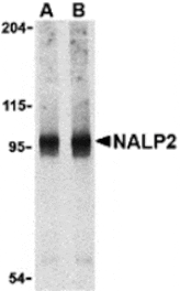Western blot - NALP2 Antibody from Signalway Antibody (24169) - Antibodies.com