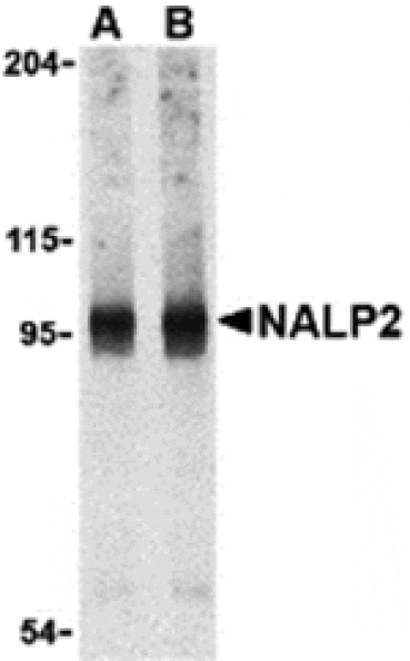 Western blot - NALP2 Antibody from Signalway Antibody (24169) - Antibodies.com