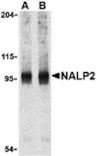 Western blot - NALP2 Antibody from Signalway Antibody (24169) - Antibodies.com