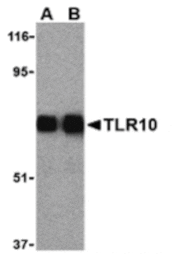 Western blot - TLR10 Antibody from Signalway Antibody (24230) - Antibodies.com