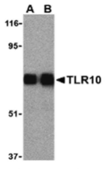 Western blot - TLR10 Antibody from Signalway Antibody (24230) - Antibodies.com