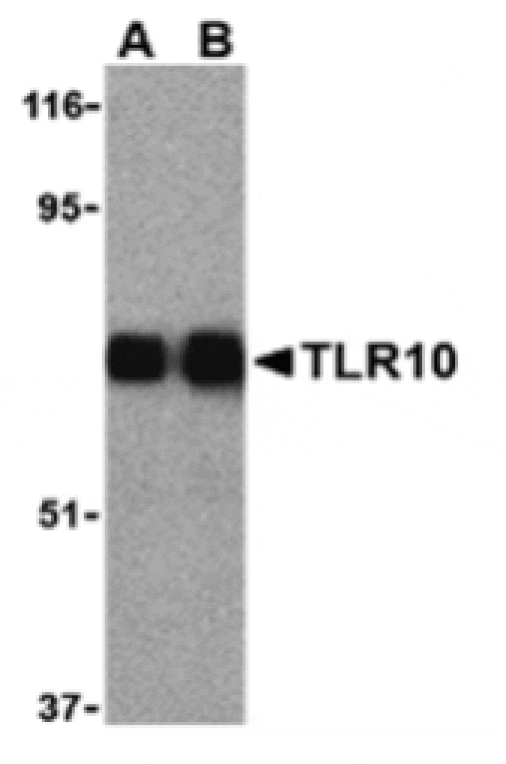 Western blot - TLR10 Antibody from Signalway Antibody (24230) - Antibodies.com