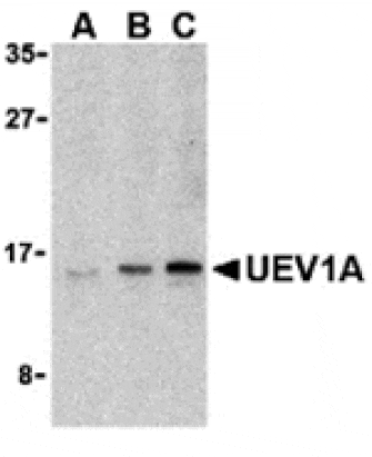 Western blot - UEV1A Antibody from Signalway Antibody (24259) - Antibodies.com