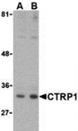 Western blot - CTRP1 Antibody from Signalway Antibody (24325) - Antibodies.com