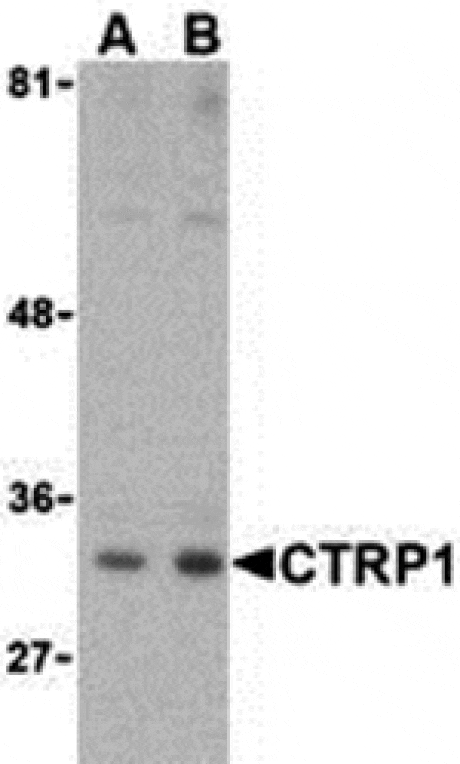 Western blot - CTRP1 Antibody from Signalway Antibody (24325) - Antibodies.com