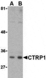 Western blot - CTRP1 Antibody from Signalway Antibody (24325) - Antibodies.com