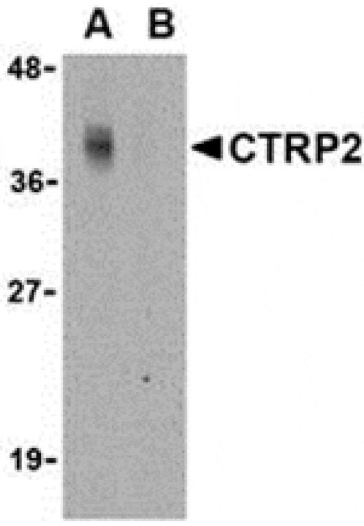 Western blot - CTRP2 Antibody from Signalway Antibody (24328) - Antibodies.com