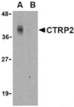 Western blot - CTRP2 Antibody from Signalway Antibody (24328) - Antibodies.com