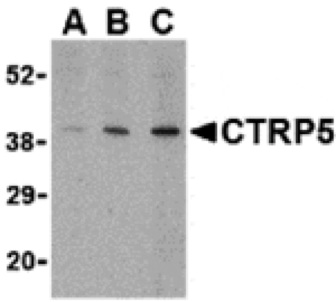 Western blot - CTRP5 Antibody from Signalway Antibody (24333) - Antibodies.com