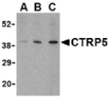 Western blot - CTRP5 Antibody from Signalway Antibody (24333) - Antibodies.com