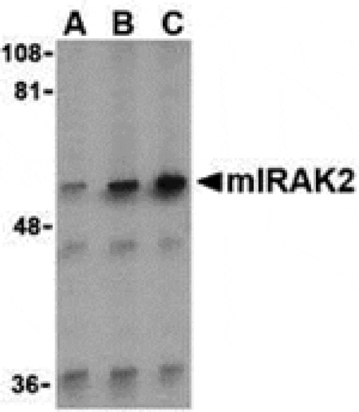 Western blot - IRAK2 Antibody from Signalway Antibody (24344) - Antibodies.com