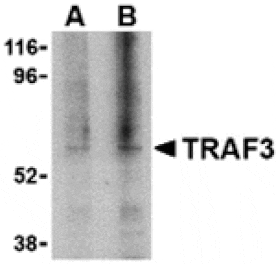 Western blot - TRAF3 Antibody from Signalway Antibody (24345) - Antibodies.com