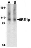 Western blot - IRE1p Antibody from Signalway Antibody (24371) - Antibodies.com