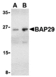 Western blot - BAP29 Antibody from Signalway Antibody (24376) - Antibodies.com