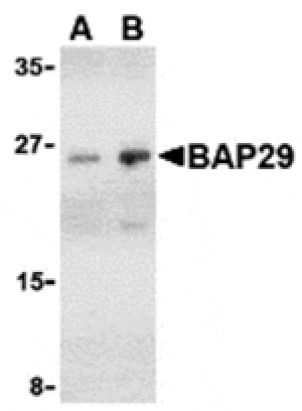 Western blot - BAP29 Antibody from Signalway Antibody (24376) - Antibodies.com